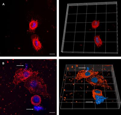 Salmonella Typhimurium Triggers Extracellular Traps Release in Murine Macrophages